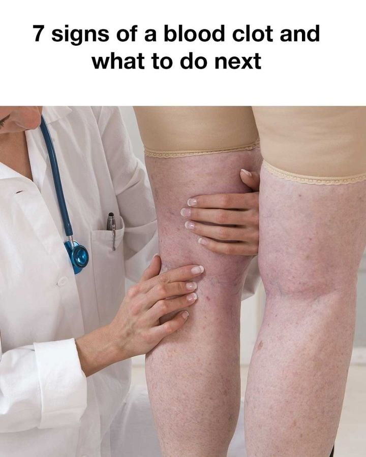 12 Unusual Warning Signs Your Liver Might Be Struggling (And Why You Shouldn’t Ignore Them)