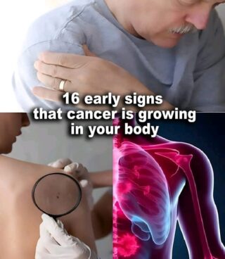 16 early signs that cancer is growing in your body