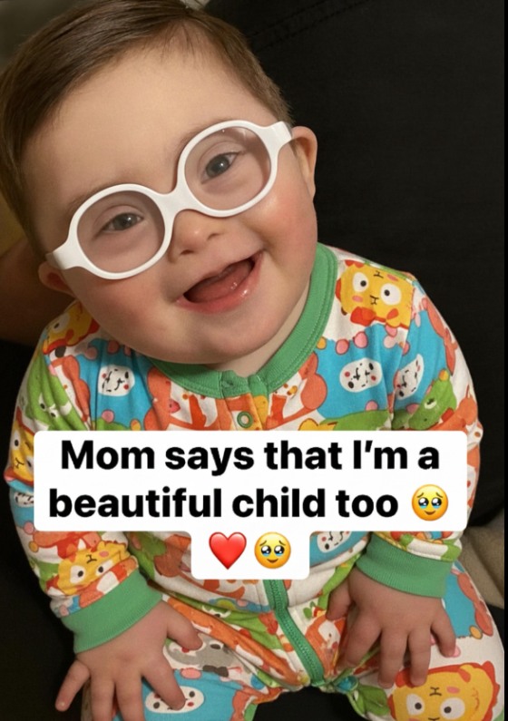 🌟💛 “Mom says I’m a beautiful child too 😊❤️😊”