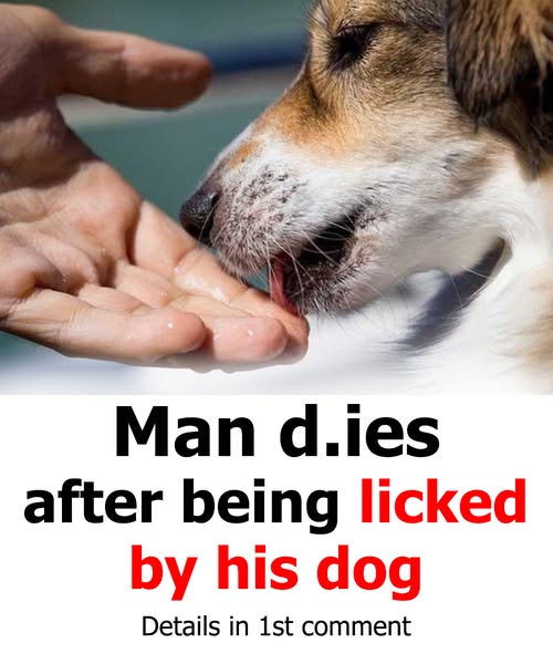 Man d.ies after being licked by his dog
