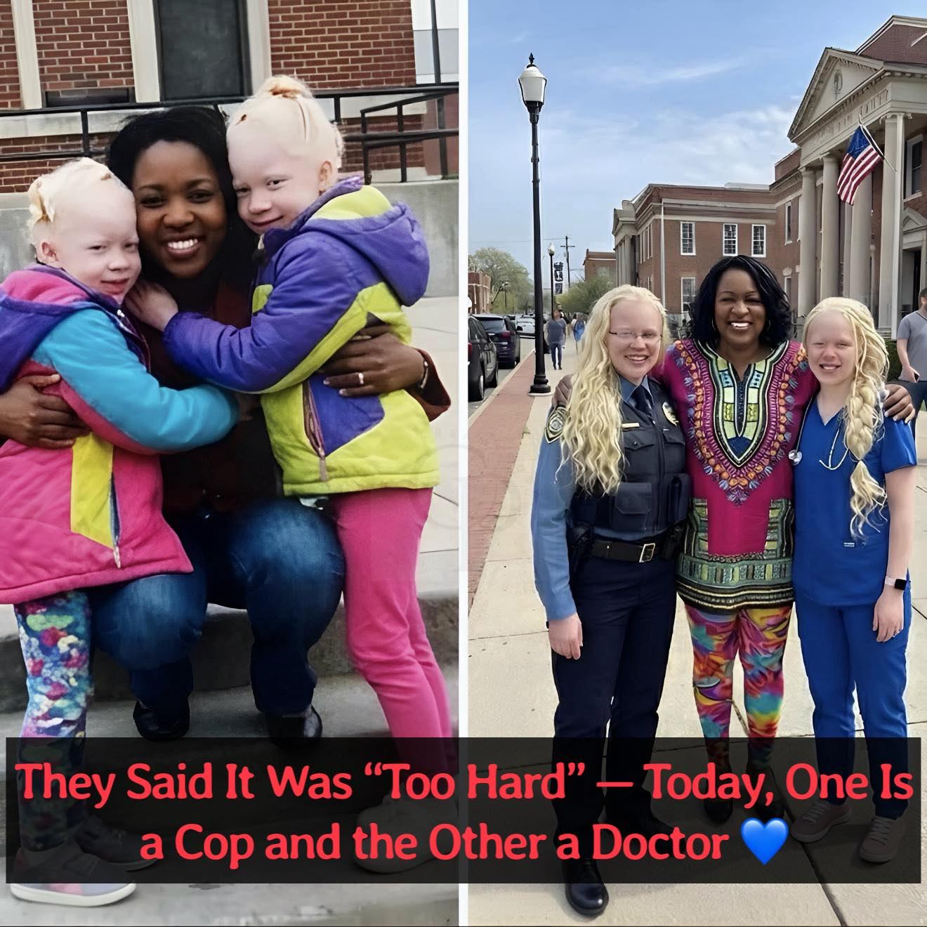 💙 “They Said It Was Too Hard — Adopting Them Changed Everything” 💙