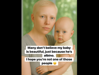 💛👶 My Albino Baby — A Light the World Can’t Dim ✨🌿