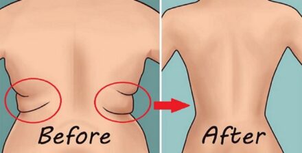 Bidding Farewell to Stubborn Belly Fat: 8 Science-Backed Tips