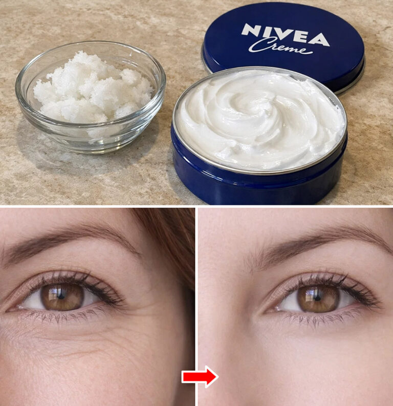 How to combine coconut oil and Nivea cream to reduce wrinkles and expression fine lines?