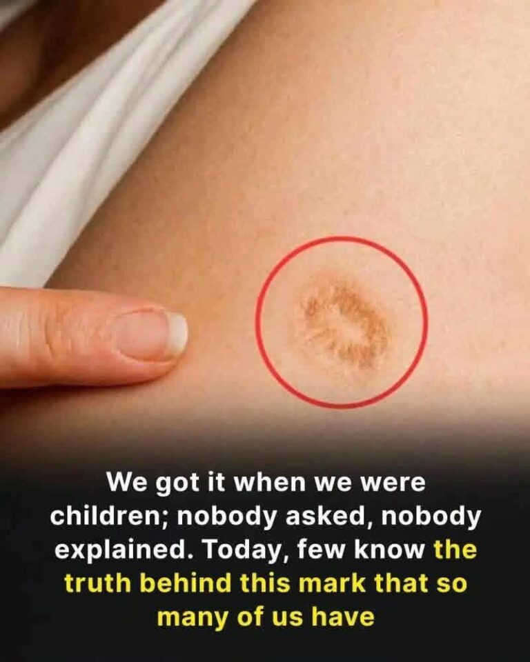 Do you have a round mark on your arm? This reveals a little-known historical detail