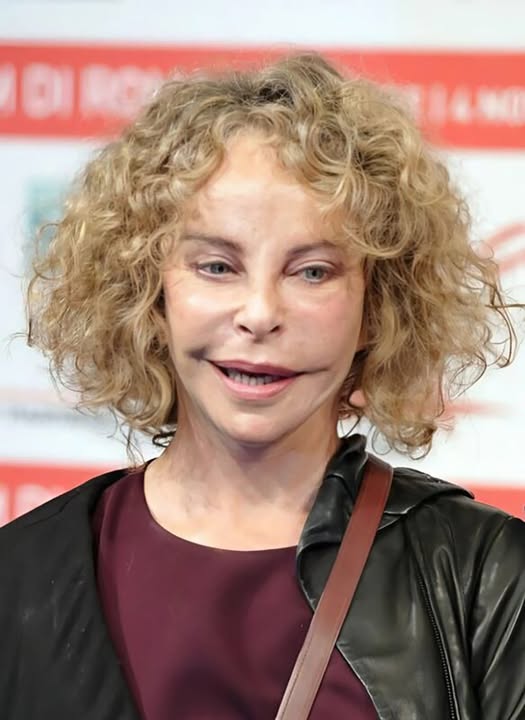 She was once the favorite of millions of people because of her atypical appearance, but she has changed dramatically because of cosmetic surgery