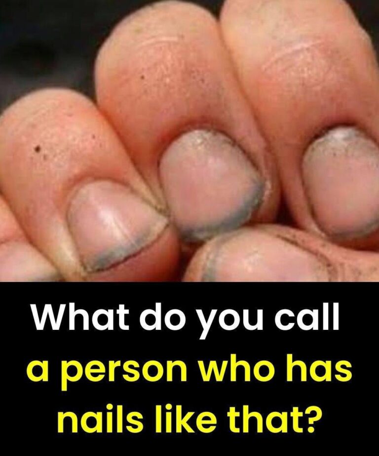 What do you call a person who has nails like that?
