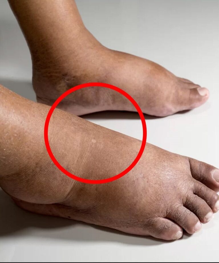 10 Natural Herbs That Help Reduce Foot Swelling and Support Healthy Circulation