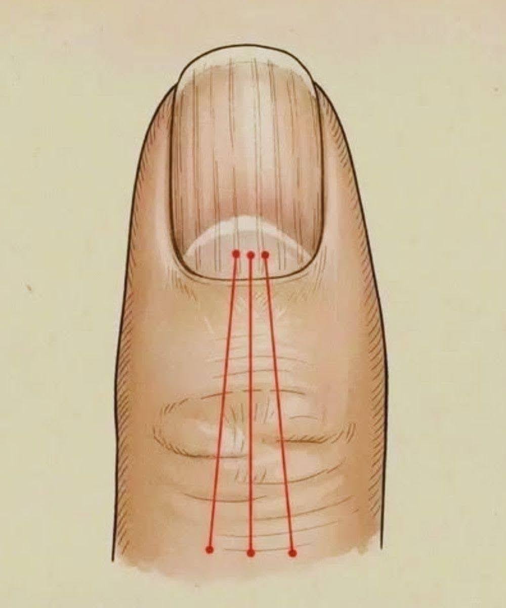 What to Eat to Reduce Nail Ridges: A Nutrition Guide for Healthier Nails