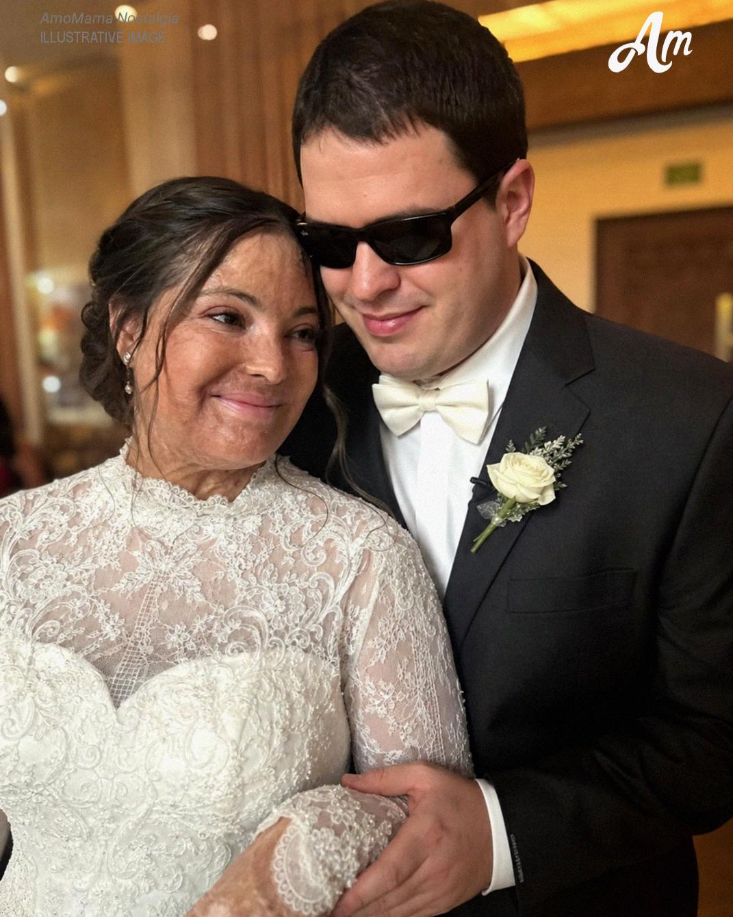 I Married a Blind Man So He’d Never See My Scars – On Our Wedding Night, He Said, ‘You Need to Know the Truth I’ve Been Hiding for 20 Years’